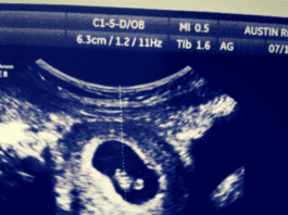 Erin is pregnant | Austin Moms Blog