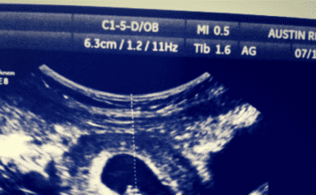 Erin is pregnant | Austin Moms Blog