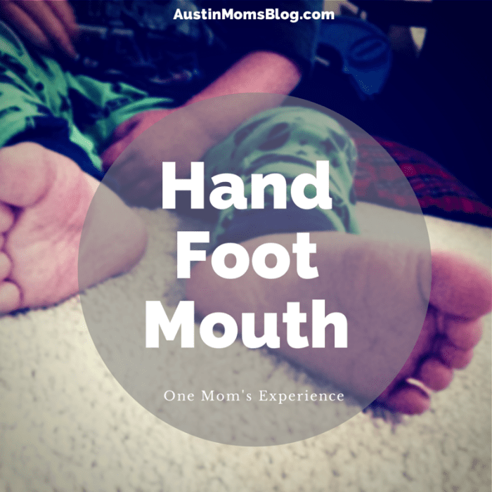 austin-moms-blog-hand-foot-mouth