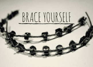 Austin Moms Blog | Prepare to Brace Yourself Luv Braces