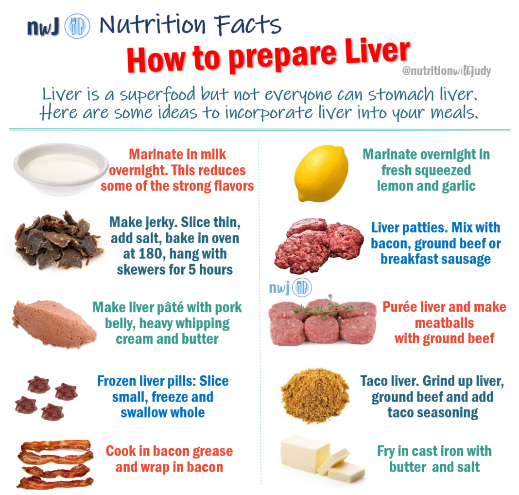 liver-histology-diagram-liver-histology-labeled